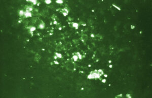 Disminución de casos de influenza se debe a las precauciones durante la pandemia, contrario a lo que afirma una publicación viral Visión de microscopio que ilustra los casos de influenza