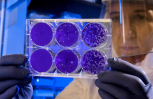 La vacunación contra el COVID-19 durante el embarazo es segura y tiene múltiples beneficios Científica estudiando la interacción de la vacuna covid y el embarazo