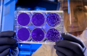 No hay pruebas de que las vacunas estén relacionadas con un exceso de muertes, contrariamente a lo que se afirma en internet Científica evaluando las supuestas muertes por vacuna Covid