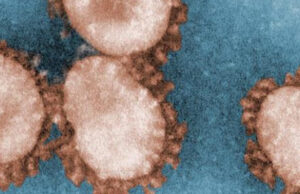 Video distorsiona las primeras investigaciones sobre coronavirus para promover una teoría de conspiración infundada sobre armas biológicas Partículas de coronavirus supuestamente usadas como armas biológicas