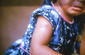 A los niños pequeños no se les ofrece tratamiento médico de transición de género Niña pequeña a quien no se le ofrecería tratamiento médico para transición de género