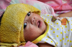 Preguntas y respuestas sobre los candidatos a vacuna materna y anticuerpos para proteger a los bebés del VRS Bebé sujeto de vacuna VRS