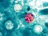 Cyclospora Infection: Symptoms, Treatment, and Food Safety Prevention Tips / Infección por Cyclospora: síntomas, tratamiento y consejos de seguridad alimentaria para la prevención Cyclospora cayetanensis