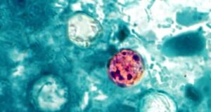 Cyclospora Infection: Symptoms, Treatment, and Food Safety Prevention Tips / Infección por Cyclospora: síntomas, tratamiento y consejos de seguridad alimentaria para la prevención Cyclospora cayetanensis
