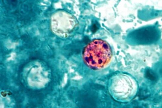 Cyclospora Infection: Symptoms, Treatment, and Food Safety Prevention Tips / Infección por Cyclospora: síntomas, tratamiento y consejos de seguridad alimentaria para la prevención Cyclospora cayetanensis