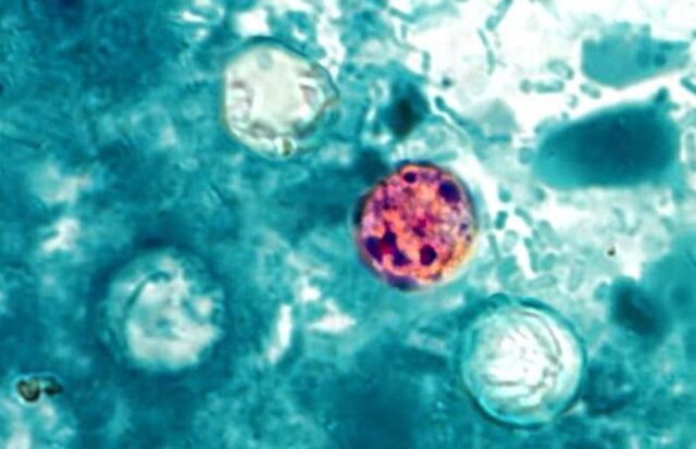 Cyclospora cayetanensis